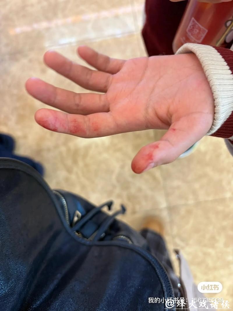 沪上知名儿童游乐机构，两岁宝摔落骨折！后面的事，家长更“心痛”